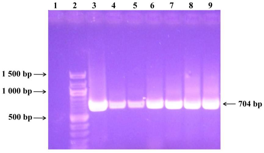 Značení křivek: červená pozitivní kontrola (DNA Lactobacillus fermentum CCM 7192T), černá negativní kontrola, modré DNA izolovaná magnetickými nosiči Fkol B 100 ox, zelené DNA izolovaná magnetickými