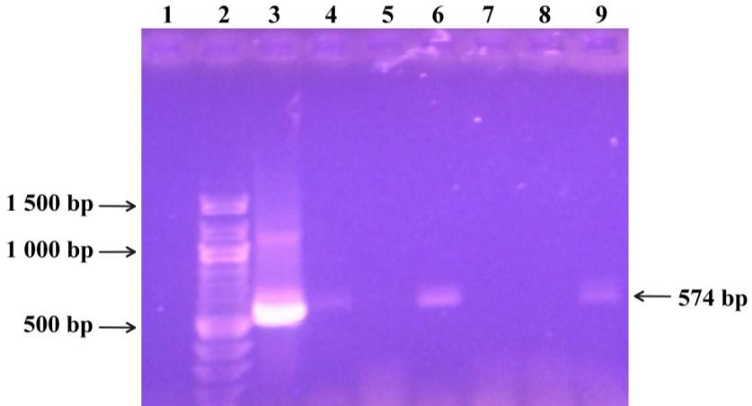 Značení křivek: červená pozitivní kontrola (DNA Lactobacillus gasseri CCM 7009T), černá negativní kontrola, modré DNA izolovaná magnetickými nosiči Fkol B 100 ox, zelené DNA izolovaná magnetickými