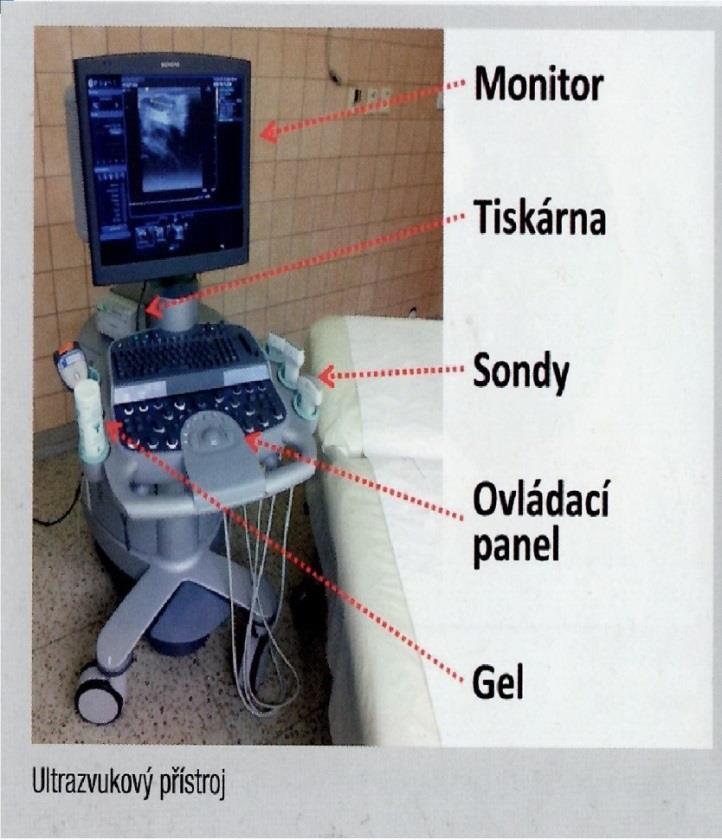 Příloha 5: Popis USG přístroj Zdroj: FERDA, Jiří, HYNEK, Mírka, BAXA, Jan, MALÁN, Alexandr.