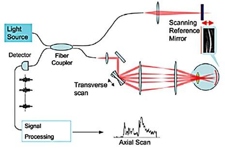 Obr. 3-1 Princip time domain OCT Obr. 3-2 Princip spectral domain OCT Srovnání technického prncipu time domain a spectral domain typu OCT Od prvního uvedení OCT se tato technologie rychle vyvíjela.