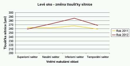 Pacient č.2: Ž 78 let Z grafů je patrné, že hodnoty u pravého oka se po roce změnily výrazněji než u levého oka. Stejně zvýšen zůstal jen inferiorní sektor s hodnotou 476 µm.