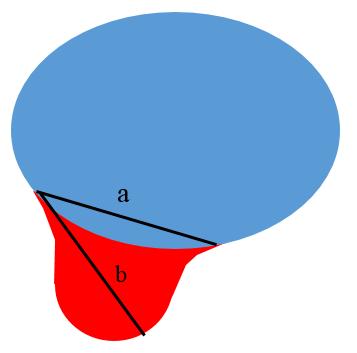 znázornění protruze meziobratlové ploténky; (axiální řez) a = vzdálenost okrajů v místě obvodu ( báze výhřezu ); b = největší průměr výhřezu v měřené (axiální) rovině; a > b = protruze (Häckel, a