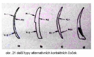 - alternativní kontaktní čočky koncentrické U těchto kontaktních čoček zóna na dálku a zóna na blízko jsou koncentricky uspořádány.