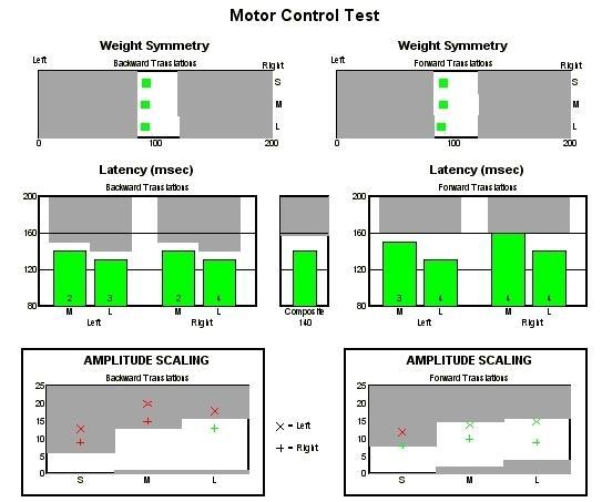 COG Alignment (umístění těžiště před začátkem jednotlivých úkolů) obr. 39 vpravo dole Vyšetření odhalilo větší zatěžování levé dolní končetiny nad normu (tmavě šedá oblast) 2.