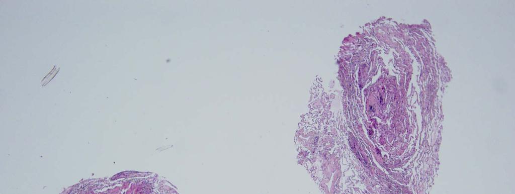 Obr.3 Histologický