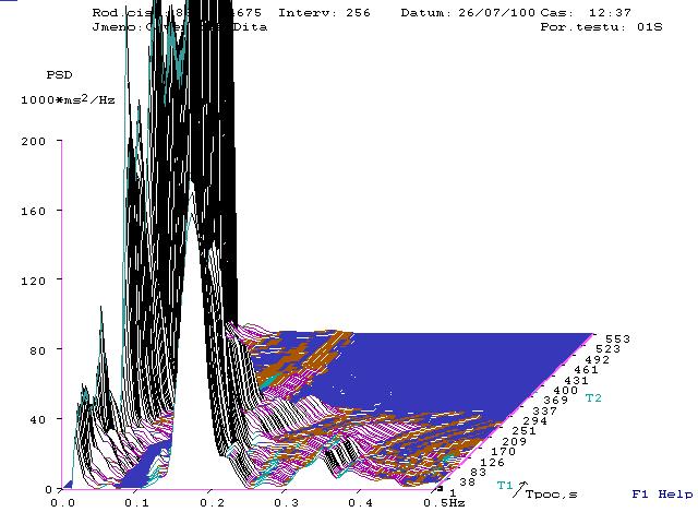 Graf 1: Příklad grafického výsledku analýzy HRV (osa x frekvence, y výkonová spektrální hustota, z čas) Graph 1: Example of graphical result of HRV analysis (axis x frequency, y power spectral