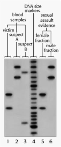 Kontrola kvality DNA typizace Dokumentace od prvního kroku (získání stopy) každé otevření zkumavky je před svědky a zapsáno Dodržování antikontaminačních opatření Pozitivní a negativní kontrola při