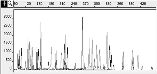 Elektroforeogram (elektroferogram) Jednotlivé barevné kanály TH01 TPOX CSF D3 D5 AMEL