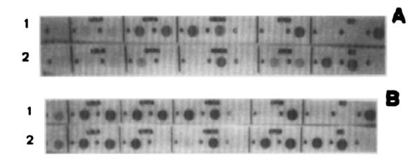 Nepřímé DNA testy Dva významy: 1. testování na úrovni proteinu vs 2. testování formy genu dle blízkého markeru na úrovni DNA Příklady pro 1.