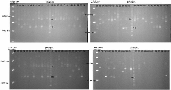 (PGM, GPT, ACP, AK, ADA, EsD, PGD) Major HistocompatibilityComplex, HLA (HLA-DRB1, -DQB1, -DQA1, -A, -B,-C).