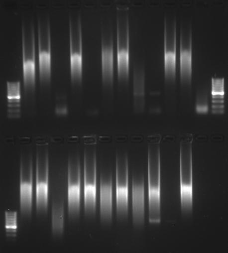4.1.4 Nálezy mikrosporidií metodou PCR Pomocí PCR bylo vyšetřeno všech 20 vzorků stolice.
