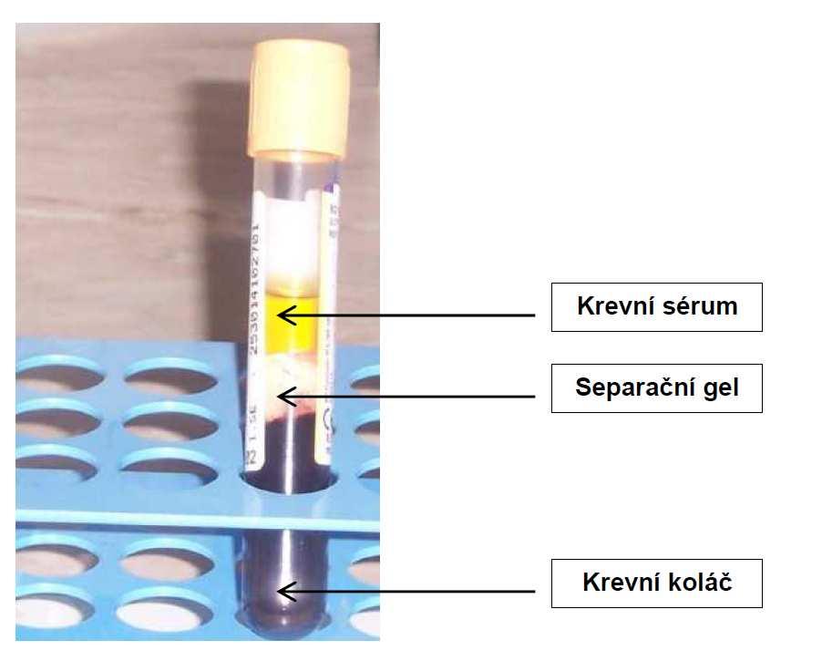 Zkumavky s biologickým materiálem vkládáme do válcových otvorů rotoru tak, aby bylo jejich rozložení přibližně symetrické.