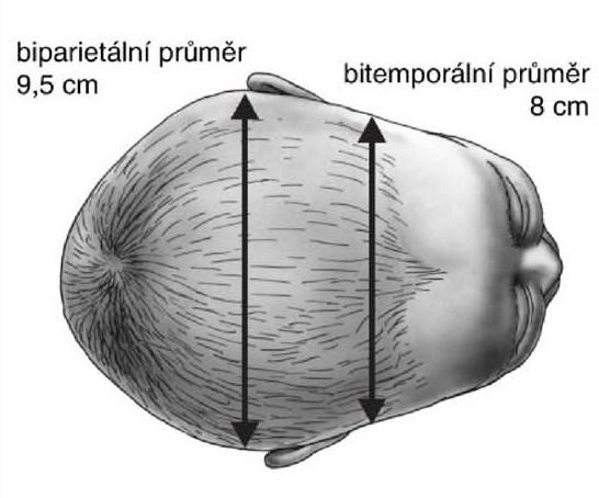 Diameter submentobregmatica sahá od středu velké fontanely k jazylce. Měří cca 9 cm a vztahuje se k němu obvod cirmuferentia submentobregmatica, který má 32 cm.