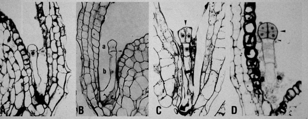 Nejranější období vzniku uspořádanosti (pattern formation) huseníčku Apikální pól Apikální linie Bazální linie