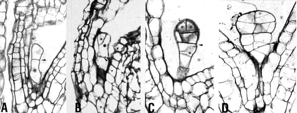 gnom Raná embryogeneze wt gnom wt gnom Narušení apikálně-bazální polarity & ztráta bilaterální symetrie Nejranější defekt: symetrické dělení zygoty produkt