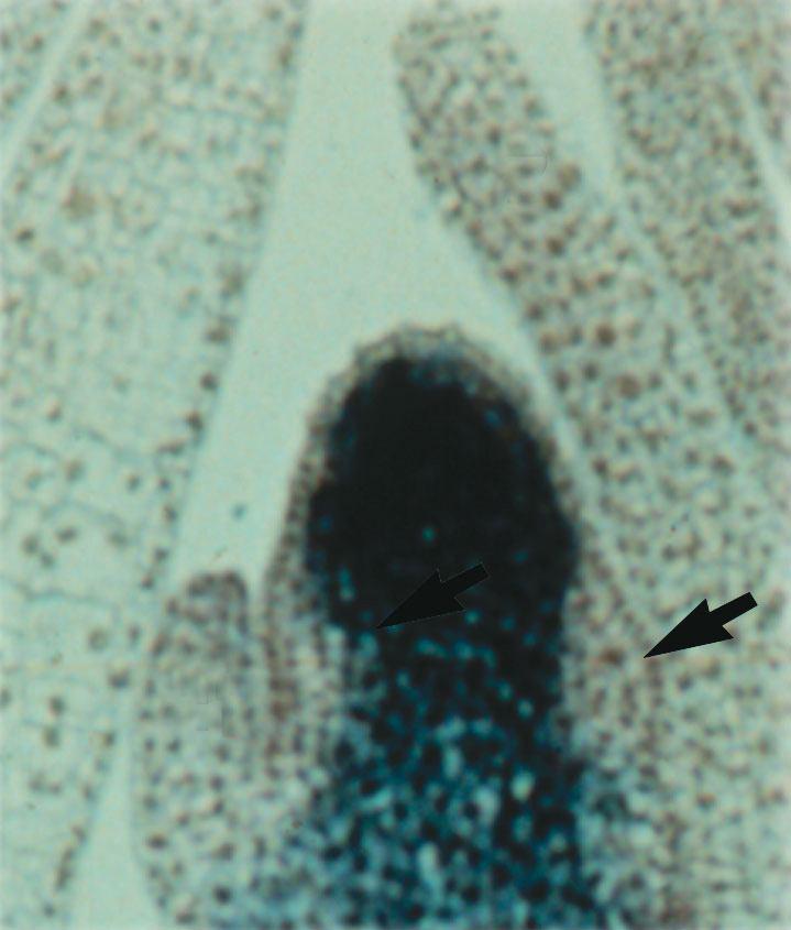 36 c) Signál pomocí přenosu mrna či proteinu Symplastická komunikace mezi buňkami = pomocí