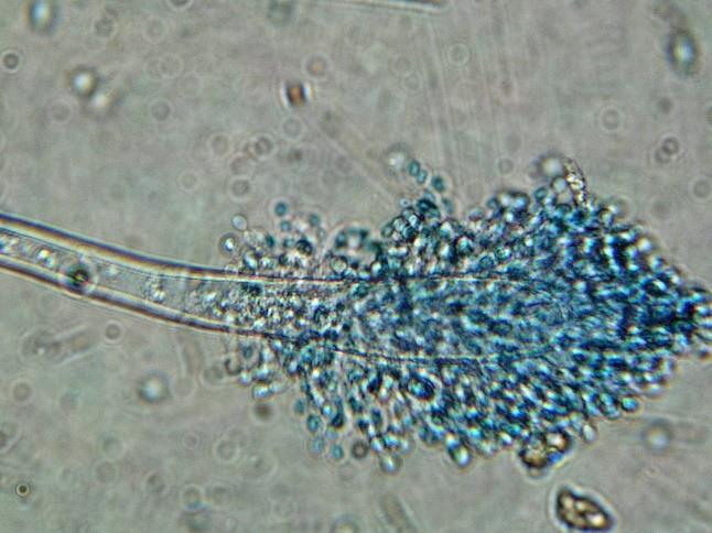 dalších významných mykotoxinů (rod Aspergillus): Kyselina