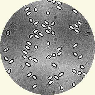 Nosema apis (hmyzomorka včelí) Glomeromycota Např.