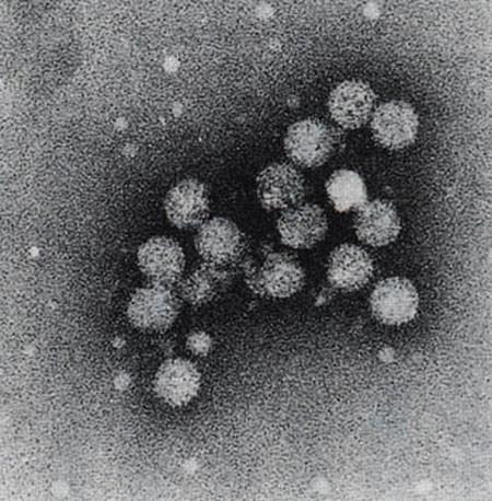 Virus hepatitidy