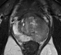 Protokol mp-mri MRI Přehledné