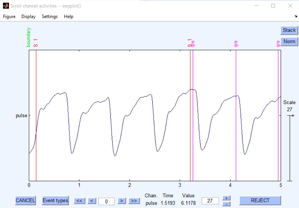 8.3 Zpracování dat pro zjištění tepové frekvence Stejně jako v předchozí kapitole byla data ze senzoru, určeného pro snímání tepu, zpracovávána v pluginu EEGLAB pro program Matlab.