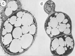 Pasivní obrana Melanin - chrání mycelium (spory) před: UV radioaktivitou vyschnutím (váže velké množství vody) extrémními teplotami chemikáliemi (H 2 O 2, volné radikály) lytickými enzymy (glukanáza,