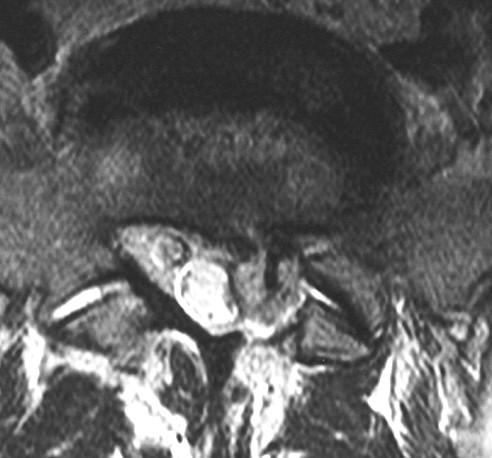 MRI CT