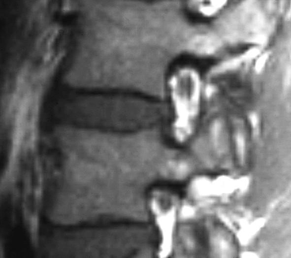 Další důležité anatomické struktury kanál