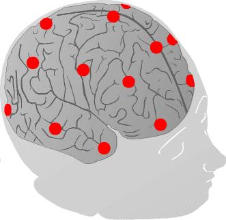EEG schéma