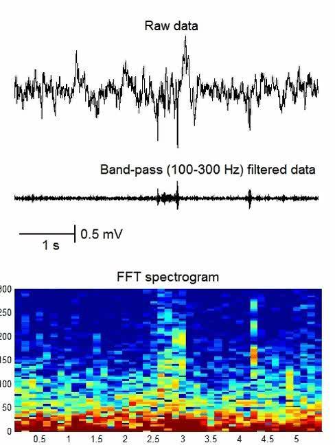 ripples EEG