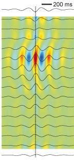 Fyziologická aktivita hipokampu - sharp wave ripples Ripples jsou charakterizovány střídáním toku proudu z buňky ven, následované tokem proudu do