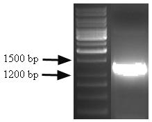 Z pcmv plazmidů nesoucích Pten a ca-akt cdna byly PCR reakcí s klonovacími primery připraveny cdna fragmenty obsahující kromě kódující sekvence také Spe1 restrikční místo. (Obr. č.