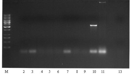 2µl kultury použity jako templát pro PCR reakci testující přítomnost pbsk vektoru se