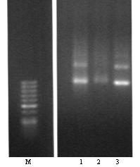 mrna kódující egfp-ca-akt (a)) a mcherry-pten (b) (1) Ty