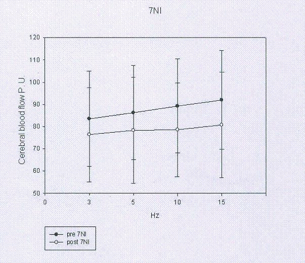 Graf 11 Změna průtoku krve mozkem před a po aplikaci 7-NI při transcallosální stimulaci Další cílem diplomové práce bylo zjistit, jaký vliv má aplikace FeTTPS na sklon křivky a práh dráždivosti