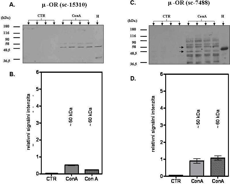 *** *** *** *** Obr. 12. Výsledky imunodetekce -opioidního receptoru v lymfocytech a grafické vyhodnocení imunoblotů. CTR - kontrolní vzorky; ConA - konkanavalinom A ovlivněné vzorky.