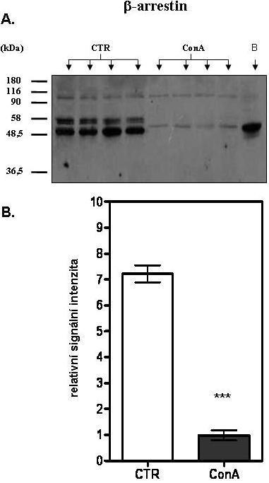 Obr. 16. Detekce β-arrestinu-1/2. (A.) Výřez z filmu, který je výsledkem imunodetekce β-arrestinu-1/2. Pozitivní kontrolou (označení písmenem B v obrázku v sekci (A.