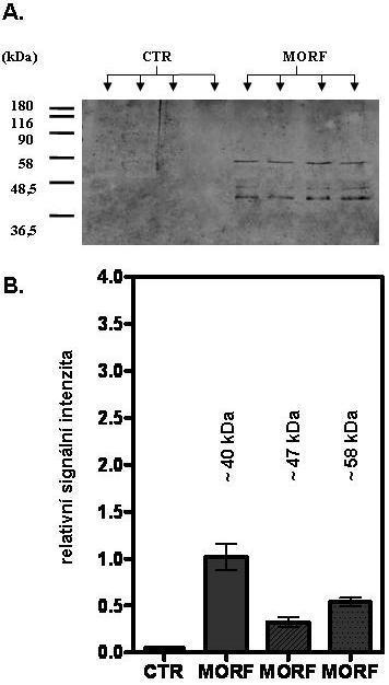 -OR *** ** *** Obr. 18. Detekce množství -opioidních receptorů v PNS z lymfocytů kontrolních a ovlivněných morfinem. (A.) Výsledek stanovení -OR metodou "Western blot". (A. B.