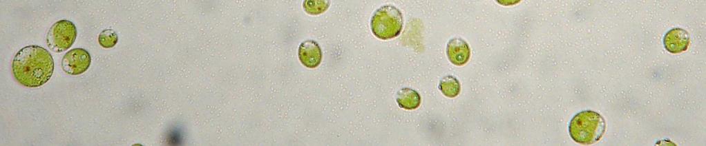 6b Červená škvrna Dva bičíky vakuola chloroplast 4.