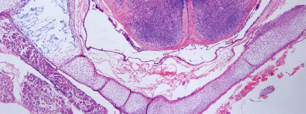 Germinální vrstva Přední rohy Komisura Stratum moleculare Purkyňovy