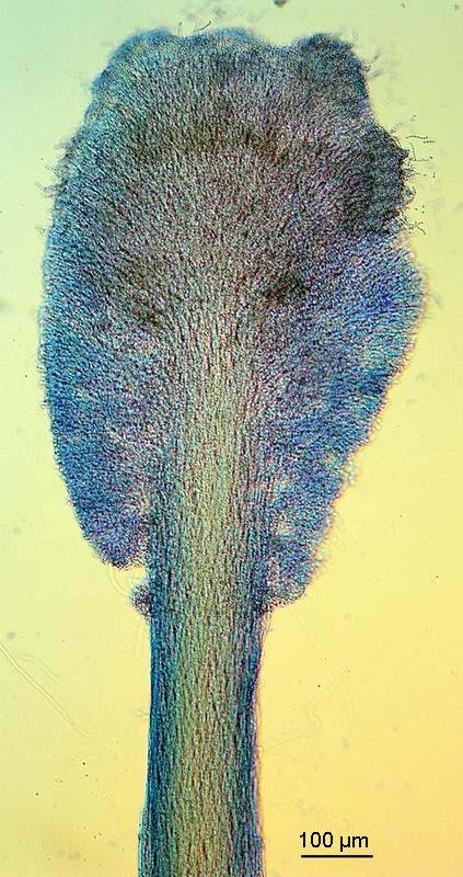 Penicillium vulpinum