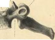 vertebraus /b /vs u tfo Obr 18.