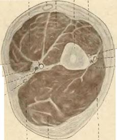 Arteria brachialis.-" Nervus ulnaris. Musc.