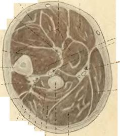 Nervus interosseus dors. Vena interossea. dors. j Arteria interossea. dors. / Musc. extensor pollicis longus.! Musc. abductor pollicis lorgus.