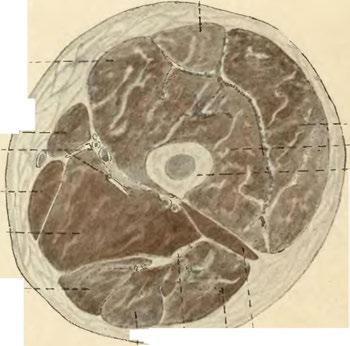 1 ' Caput longum J Musc. semitendinosus. \ Nervus ischiadicus. Obr.