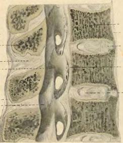 - Arcus vertebrae^ lumb. 2. Lig. longitudinale post. Lig. supraspinale.