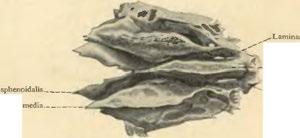 Cellulae ethmoidales. Obr. 97.