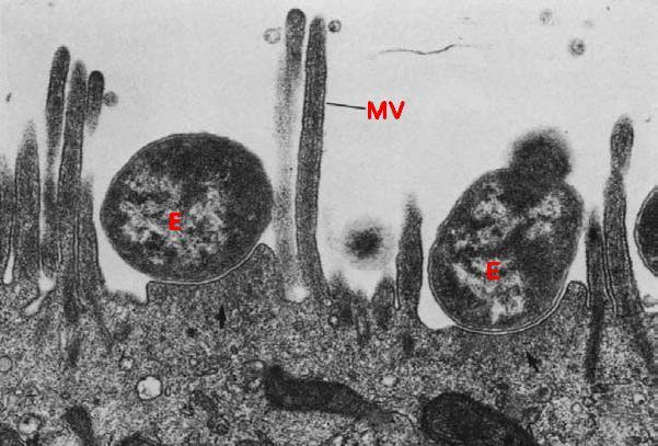 7. Enteropatogenní E. coli Enteropatogenní E.