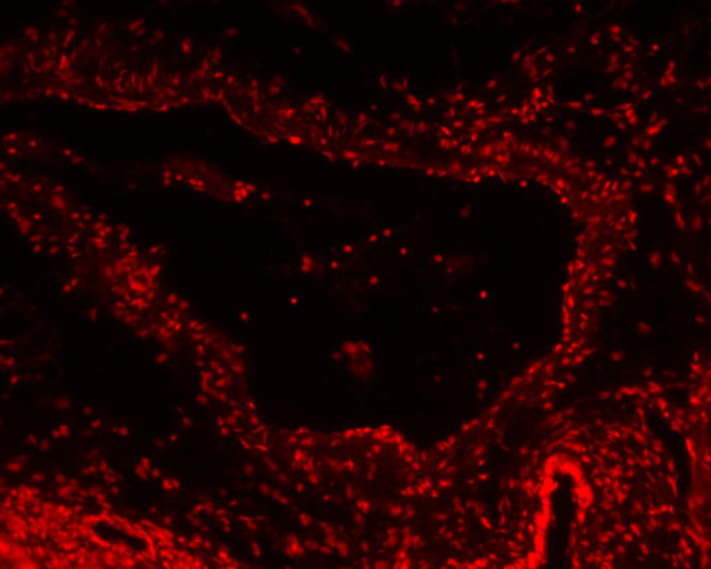 Barvivo neprochází nepoškozenou cytoplazmatickou membránou živých buněk, ale pokud mají buňky porušenou membránu, barvivo může