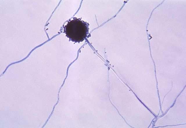 Podod. Pezizomycotina Třída Eurotiomycetes Řád Eurotiales Aspergillus niger (kropidlák černý) choroby zvířat i lidí aspergilozy, užití při výrobě kys.